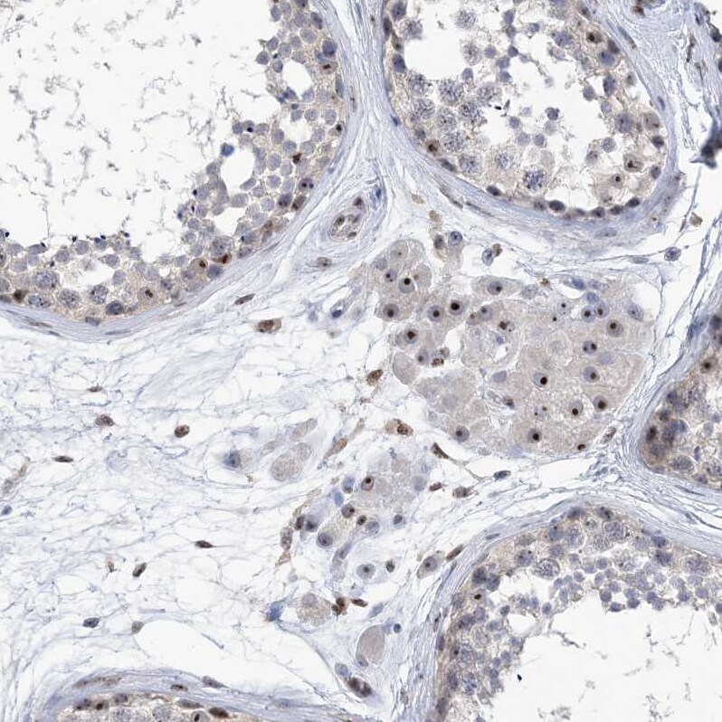 MPHOSPH10 Antibody - BSA Free Immunohistochemistry: MPHOSPH10 Antibody - BSA Free [NBP1-84341]
