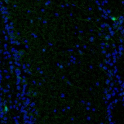 PBK Antibody - BSA Free Immunohistochemistry: PBK Antibody - BSA Free [NBP1-84342]