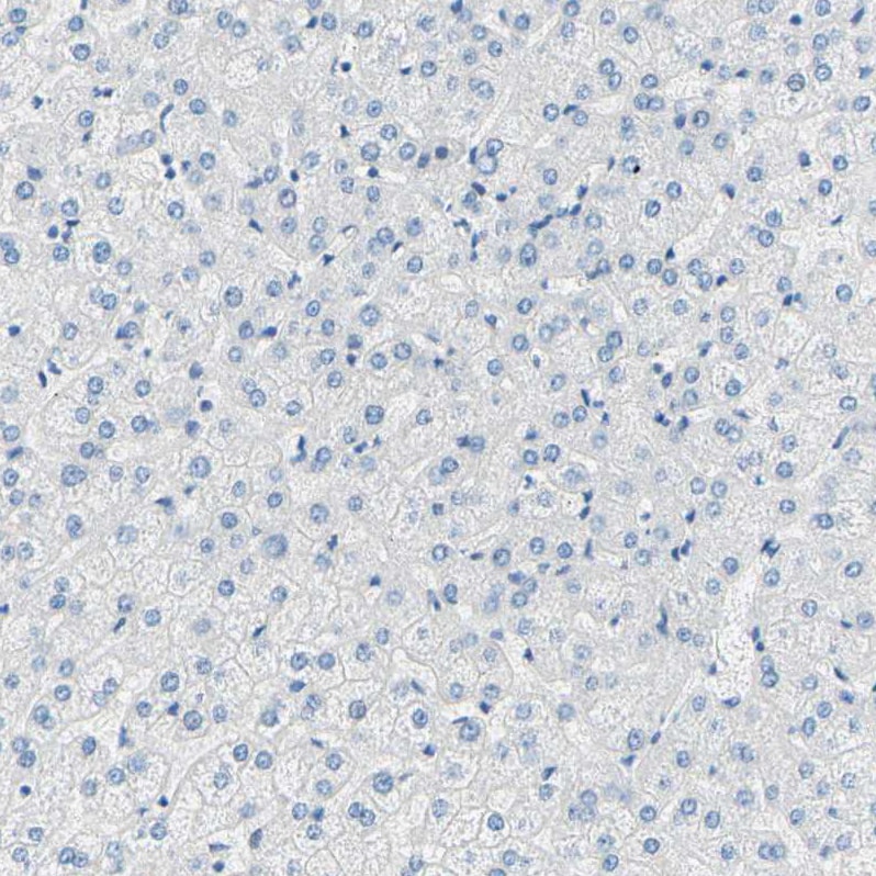 PASD1 Antibody - BSA Free Immunohistochemistry-Paraffin: PASD1 Antibody - BSA Free [NBP1-84345]