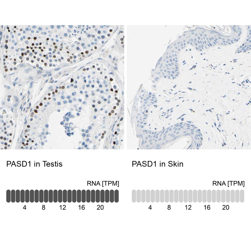 PASD1 Antibody - BSA Free Immunohistochemistry-Paraffin: PASD1 Antibody - BSA Free [NBP1-84345]