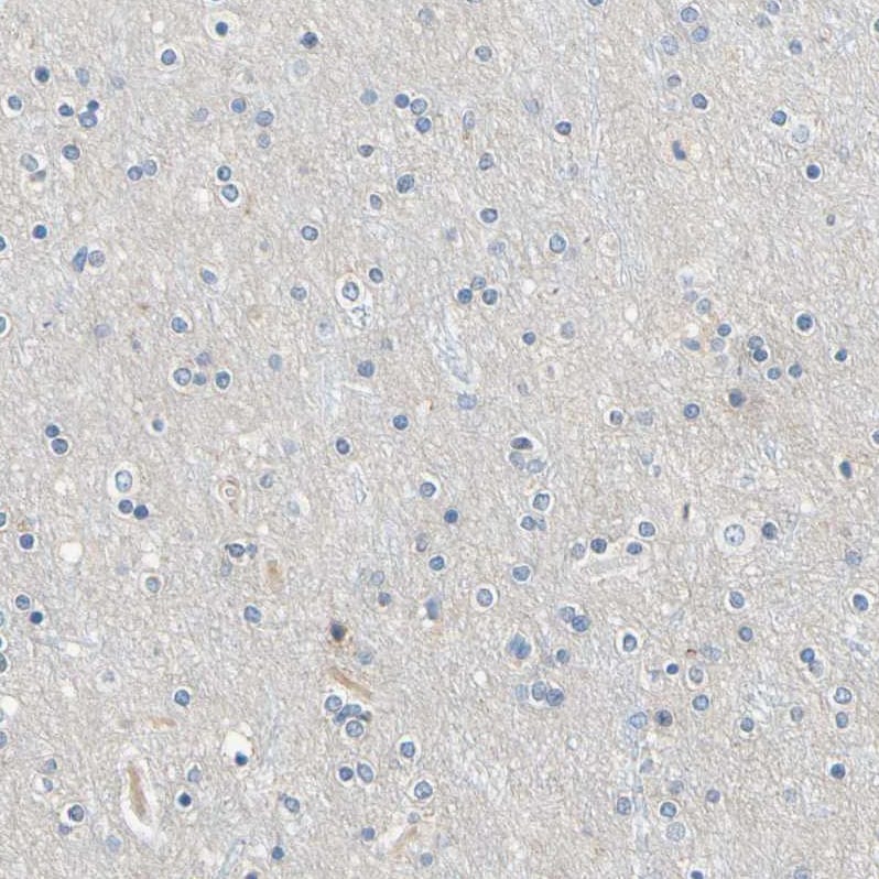 PASD1 Antibody - BSA Free Immunohistochemistry-Paraffin: PASD1 Antibody - BSA Free [NBP1-84345]
