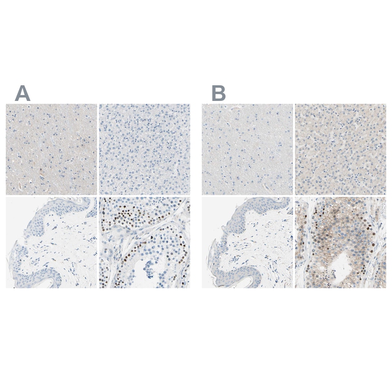 PASD1 Antibody - BSA Free Immunohistochemistry-Paraffin: PASD1 Antibody - BSA Free [NBP1-84345]