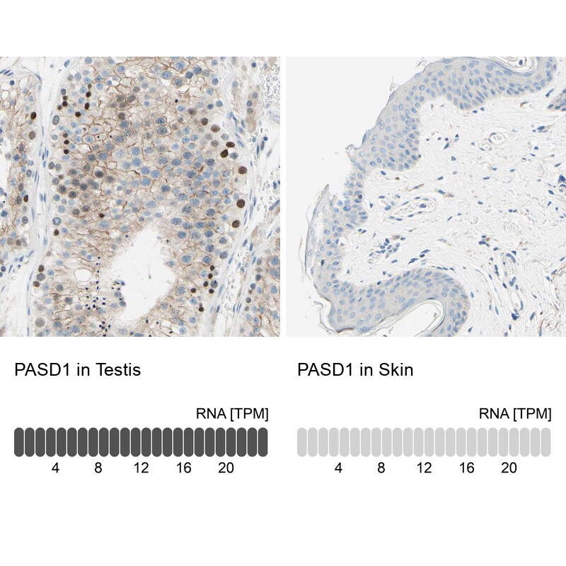 PASD1 Antibody - BSA Free Immunohistochemistry-Paraffin: PASD1 Antibody - BSA Free [NBP1-84346]