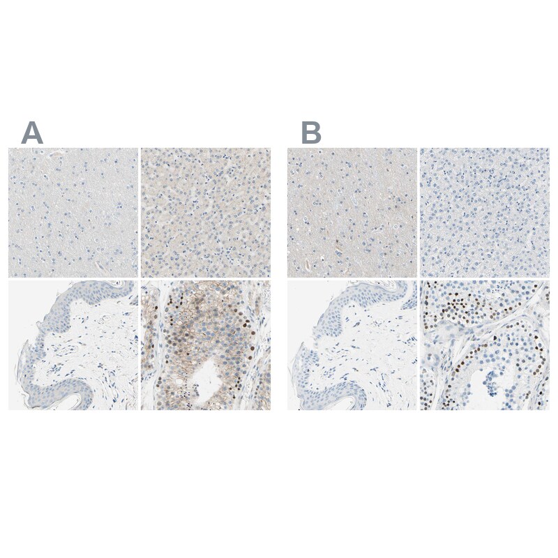 PASD1 Antibody - BSA Free Immunohistochemistry-Paraffin: PASD1 Antibody - BSA Free [NBP1-84346]