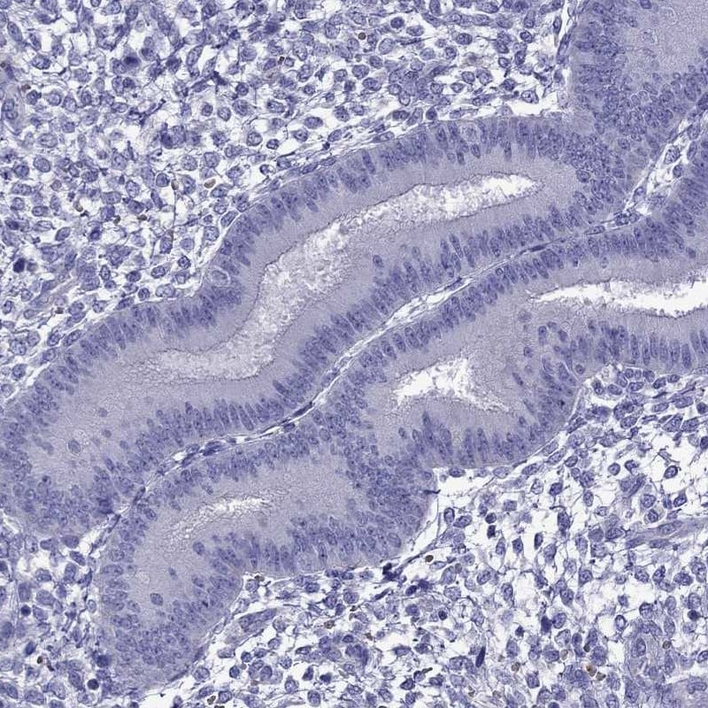 TDRD1 Antibody - BSA Free Immunohistochemistry: TDRD1 Antibody - BSA Free [NBP1-84349]