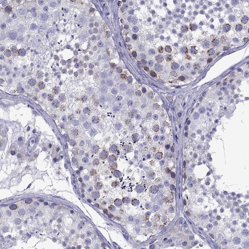TDRD1 Antibody - BSA Free Immunohistochemistry: TDRD1 Antibody - BSA Free [NBP1-84349]