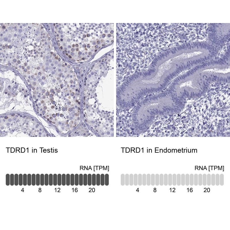 TDRD1 Antibody - BSA Free Immunohistochemistry: TDRD1 Antibody - BSA Free [NBP1-84349]