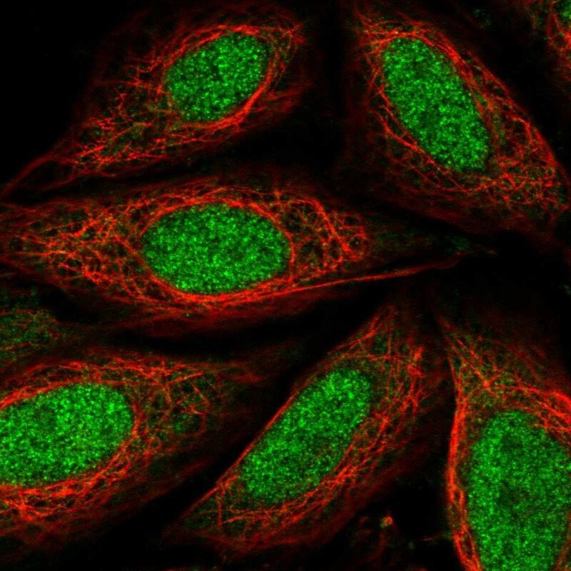 TAF7L Antibody - BSA Free Immunocytochemistry/ Immunofluorescence: TAF7L Antibody [NBP1-84350]