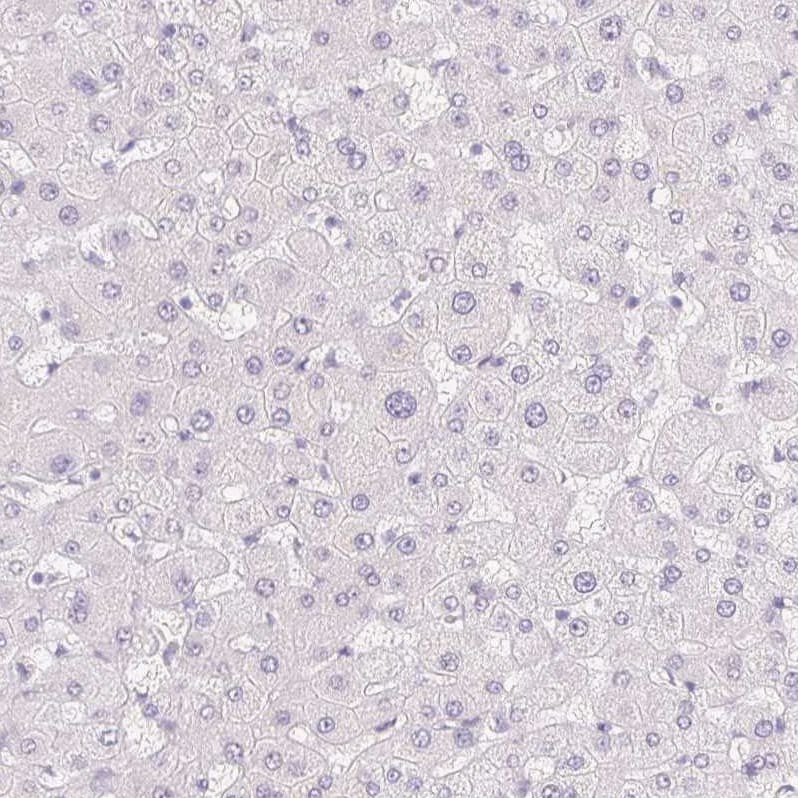 MORC1 Antibody - BSA Free Immunohistochemistry-Paraffin: MORC1 Antibody - BSA Free [NBP1-84351]