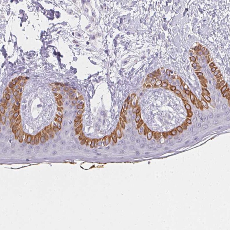 MORC1 Antibody - BSA Free Immunohistochemistry-Paraffin: MORC1 Antibody - BSA Free [NBP1-84351]