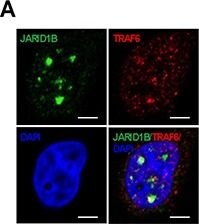 Lysine (K)-specific Demethylase 5B/KDM5B/JARID1B Antibody - BSA Free