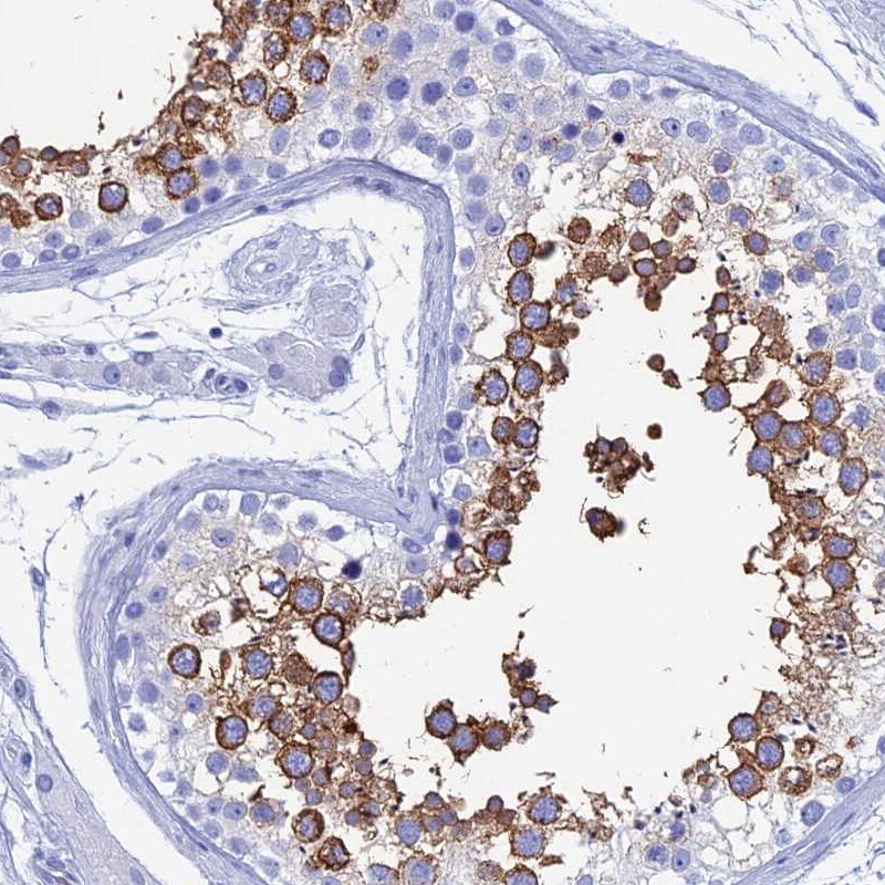 TEX101 Antibody - BSA Free Immunohistochemistry-Paraffin: TEX101 Antibody - BSA Free [NBP1-84356]