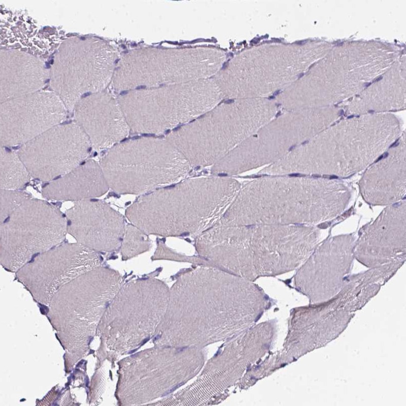 Sperm Flagellar 2 Antibody - BSA Free Immunohistochemistry-Paraffin: Sperm Flagellar 2 Antibody [NBP1-84361]