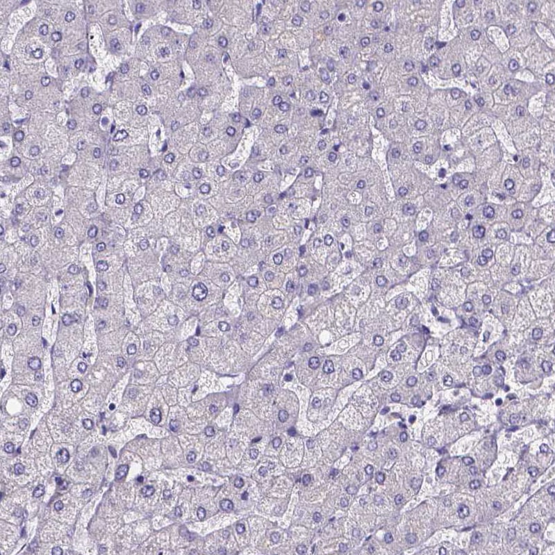 Sperm Flagellar 2 Antibody - BSA Free Immunohistochemistry-Paraffin: Sperm Flagellar 2 Antibody [NBP1-84361]