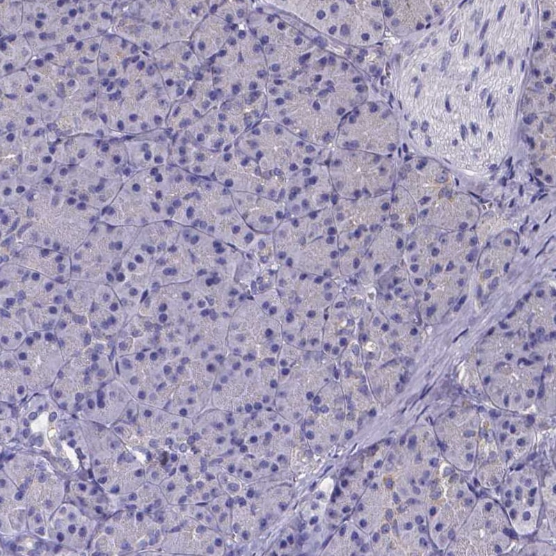Sperm Flagellar 2 Antibody - BSA Free Immunohistochemistry-Paraffin: Sperm Flagellar 2 Antibody [NBP1-84361]