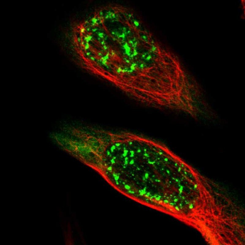 MAGEA4 Antibody - BSA Free Immunocytochemistry/ Immunofluorescence: MAGEA4 Antibody [NBP1-84365]