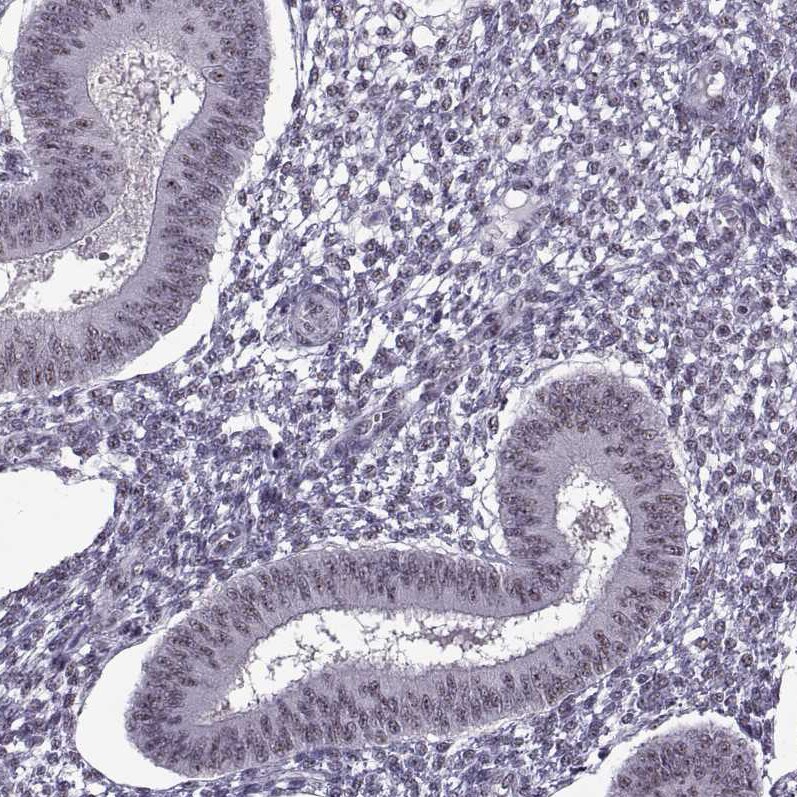MAGEA4 Antibody - BSA Free Immunohistochemistry-Paraffin: MAGEA4 Antibody - BSA Free [NBP1-84365]