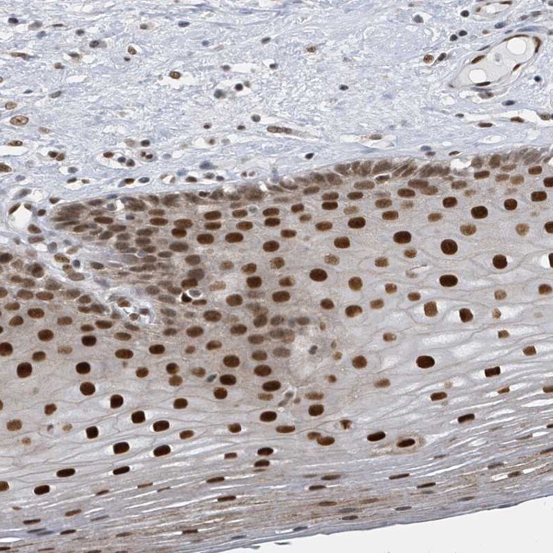 PCYT1A Antibody - BSA Free Immunohistochemistry-Paraffin: PCYT1A Antibody [NBP1-84366]