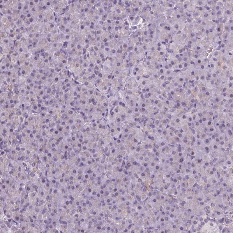 Neurocan Antibody - BSA Free Immunohistochemistry: Neurocan Antibody - BSA Free [NBP1-84368]