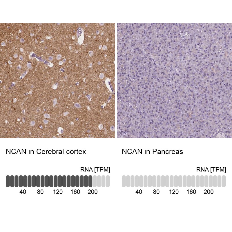 Neurocan Antibody - BSA Free Immunohistochemistry: Neurocan Antibody - BSA Free [NBP1-84368]