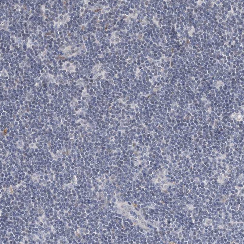 SIAE Antibody - BSA Free Immunohistochemistry-Paraffin: SIAE Antibody - BSA Free [NBP1-84371]