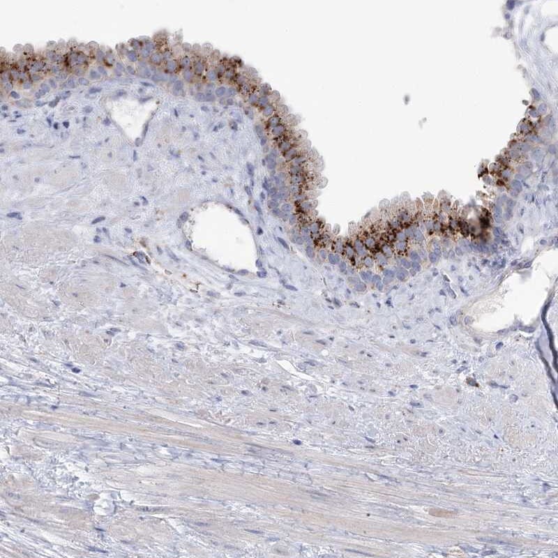 SIAE Antibody - BSA Free Immunohistochemistry-Paraffin: SIAE Antibody [NBP1-84372]