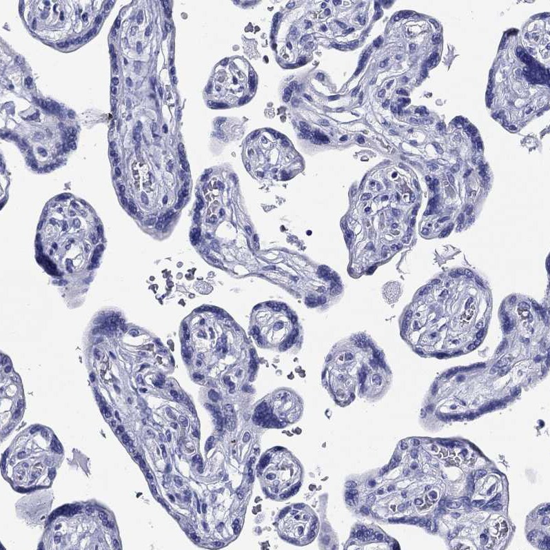 CRYGS Antibody - BSA Free Immunohistochemistry-Paraffin: CRYGS Antibody - BSA Free [NBP1-84375]