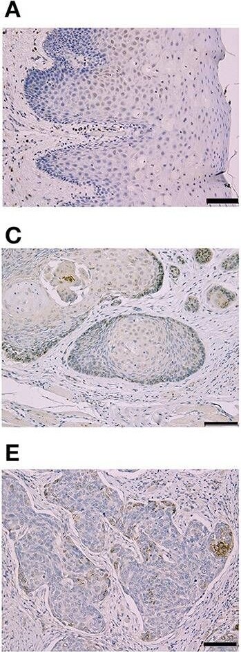CLPTM1L Antibody