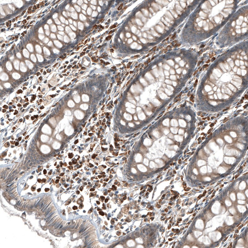 GADD45G Antibody - BSA Free Immunohistochemistry-Paraffin: GADD45G Antibody - BSA Free [NBP1-84385]