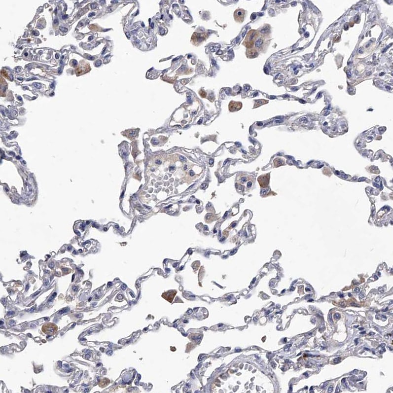 Complement C5 Antibody - BSA Free Immunohistochemistry: Complement C5 Antibody - BSA Free [NBP1-84395]
