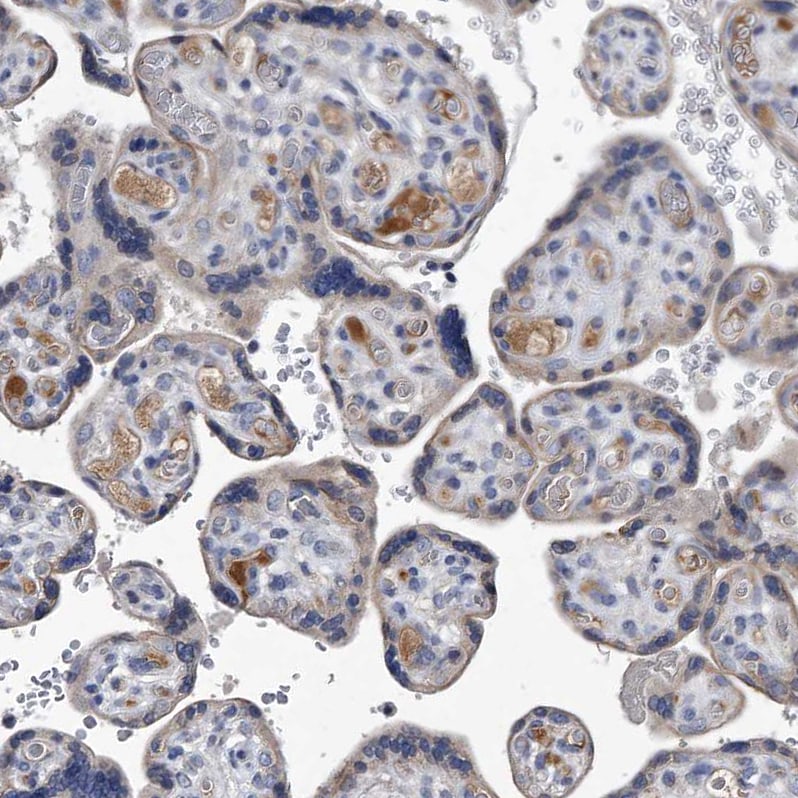 Complement C5 Antibody - BSA Free Immunohistochemistry: Complement C5 Antibody - BSA Free [NBP1-84395]