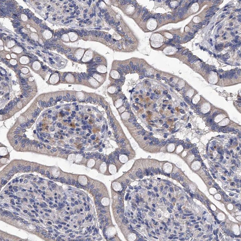 Complement C5 Antibody - BSA Free Immunohistochemistry: Complement C5 Antibody - BSA Free [NBP1-84395]