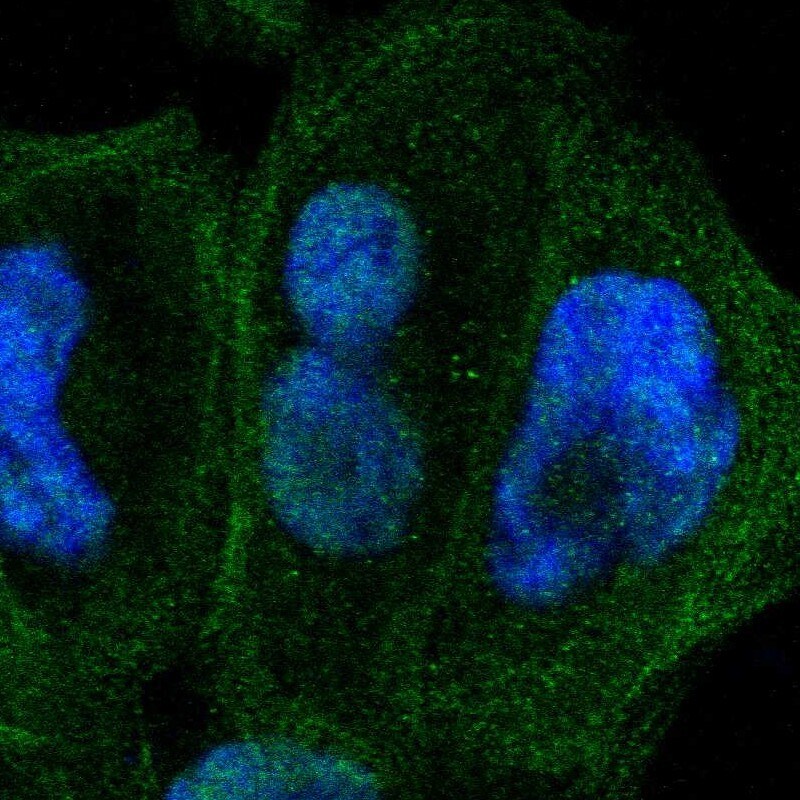 ZNF74 Antibody - BSA Free Immunocytochemistry/ Immunofluorescence: ZNF74 Antibody [NBP1-84401]