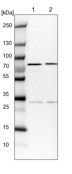 COG6 Antibody - BSA Free Western Blot: COG6 Antibody - BSA Free [NBP1-84410]