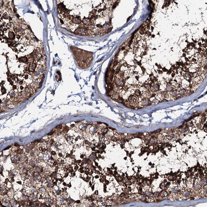 COG6 Antibody - BSA Free Immunohistochemistry-Paraffin: COG6 Antibody [NBP1-84411]