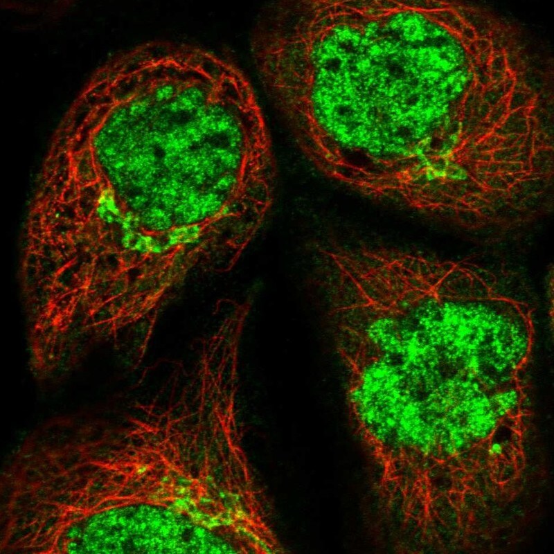 COG6 Antibody - BSA Free Immunocytochemistry/ Immunofluorescence: COG6 Antibody - BSA Free [NBP1-84411]