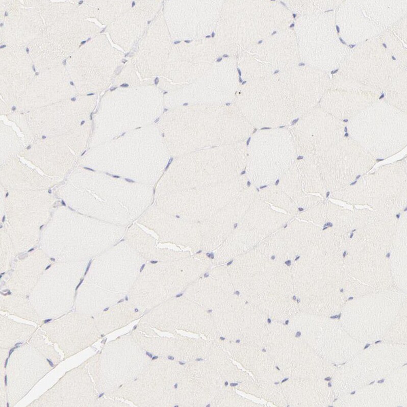 RPGR Antibody - BSA Free Immunohistochemistry-Paraffin: RPGR Antibody - BSA Free [NBP1-84412]