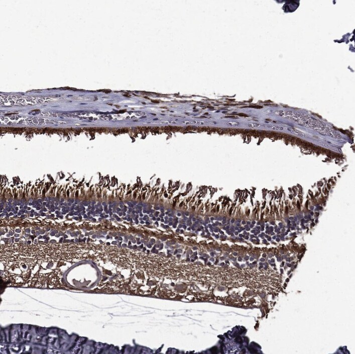 RPGR Antibody - BSA Free Immunohistochemistry-Paraffin: RPGR Antibody - BSA Free [NBP1-84412]