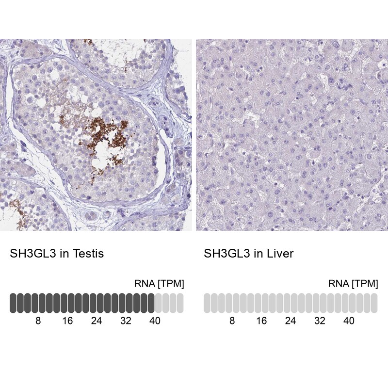 SH3GL3 Antibody - BSA Free Immunohistochemistry-Paraffin: SH3GL3 Antibody - BSA Free [NBP1-84419]