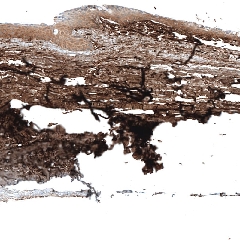 KERA Antibody - BSA Free Immunohistochemistry: KERA Antibody - BSA Free [NBP1-84425]