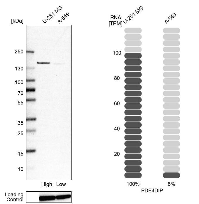 Myomegalin Antibody - BSA Free Western Blot: Myomegalin Antibody - BSA Free [NBP1-84428]