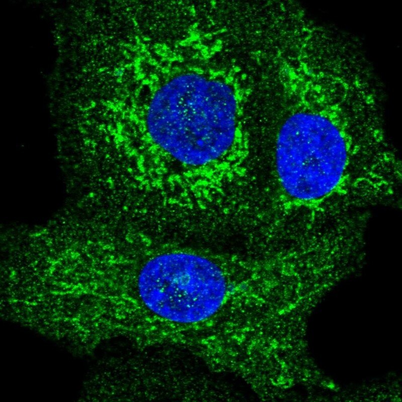 GDAP1 Antibody - BSA Free Immunocytochemistry/ Immunofluorescence: GDAP1 Antibody [NBP1-84430]