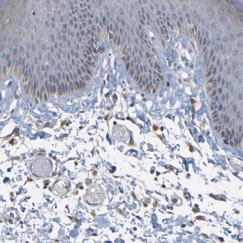 GDAP1 Antibody - BSA Free Immunohistochemistry-Paraffin: GDAP1 Antibody - BSA Free [NBP1-84430]