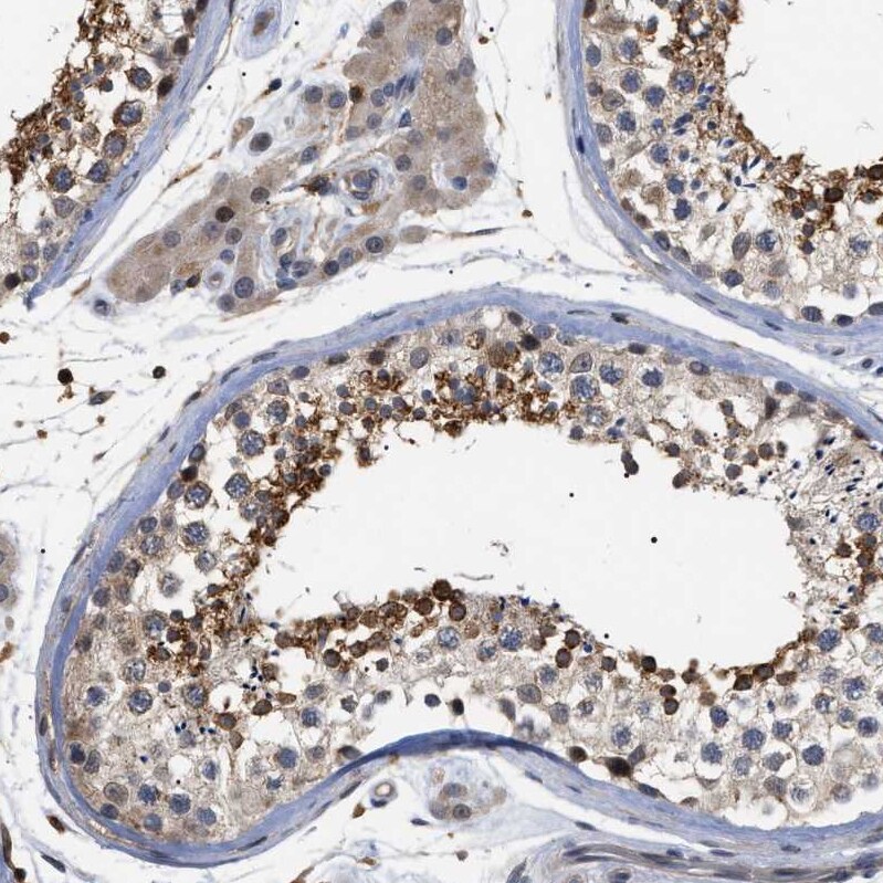 CD300a/LMIR1 Antibody - BSA Free Immunohistochemistry-Paraffin: CD300a/LMIR1 Antibody - BSA Free [NBP1-84431]