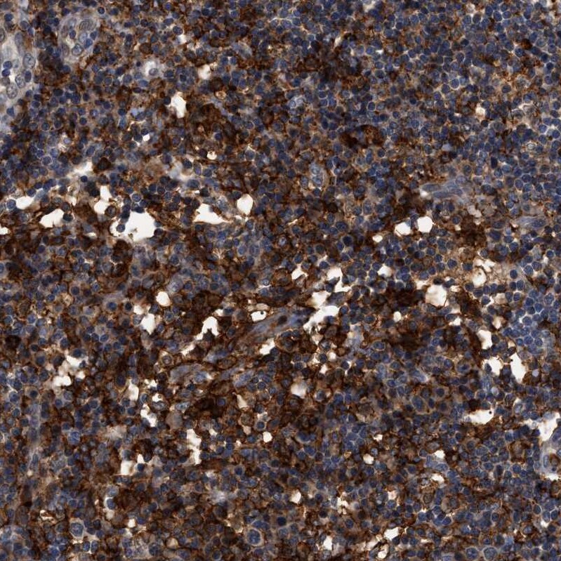 CD300a/LMIR1 Antibody - BSA Free Immunohistochemistry-Paraffin: CD300a/LMIR1 Antibody - BSA Free [NBP1-84431]