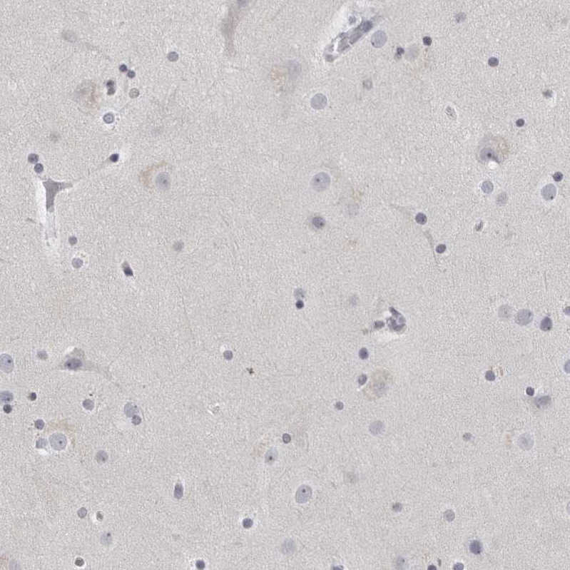 Matrilin-1 Antibody - BSA Free Immunohistochemistry: Matrilin-1 Antibody - BSA Free [NBP1-84433]