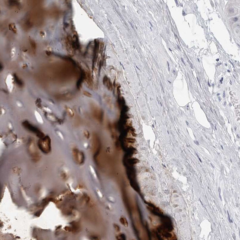 Matrilin-1 Antibody - BSA Free Immunohistochemistry: Matrilin-1 Antibody - BSA Free [NBP1-84433]