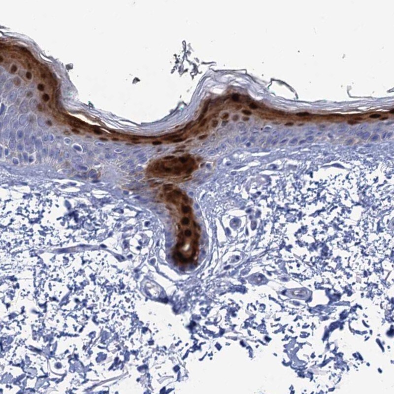 CALML5 Antibody - BSA Free Immunohistochemistry-Paraffin: CALML5 Antibody - BSA Free [NBP1-84437]