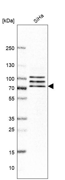 CNOT4 Antibody - BSA Free Western Blot: CNOT4 Antibody - BSA Free [NBP1-84439]