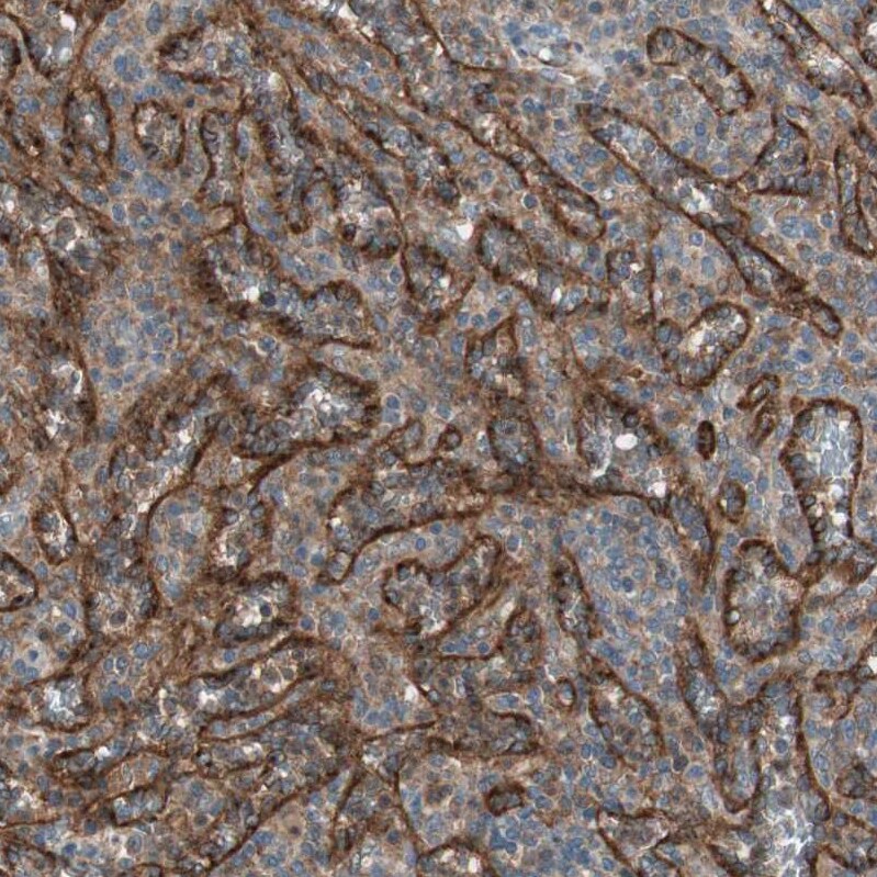 Stabilin-1 Antibody - BSA Free Immunohistochemistry-Paraffin: Stabilin-1 Antibody - BSA Free [NBP1-84444]